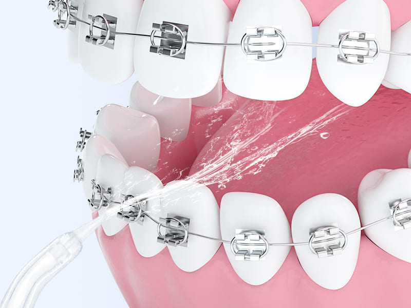 IRRIGADOR BUCAL PORTATIL® 4 EN 1 PARA LIMPIEZA DENTAL