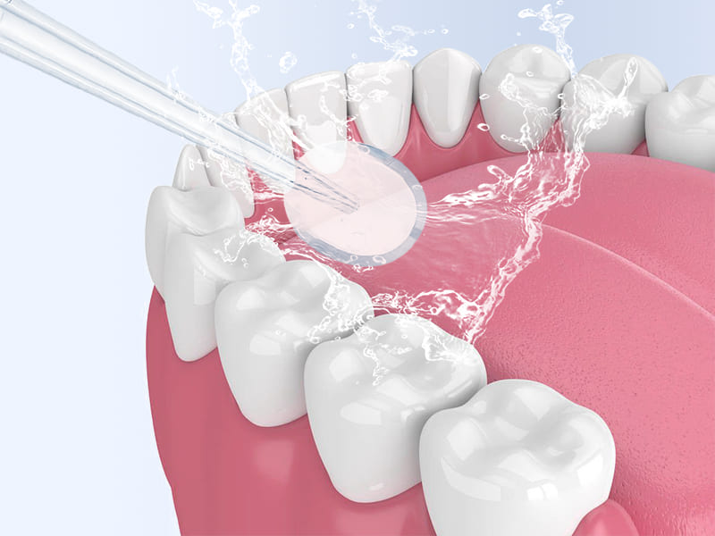 IRRIGADOR BUCAL PORTATIL® 4 EN 1 PARA LIMPIEZA DENTAL