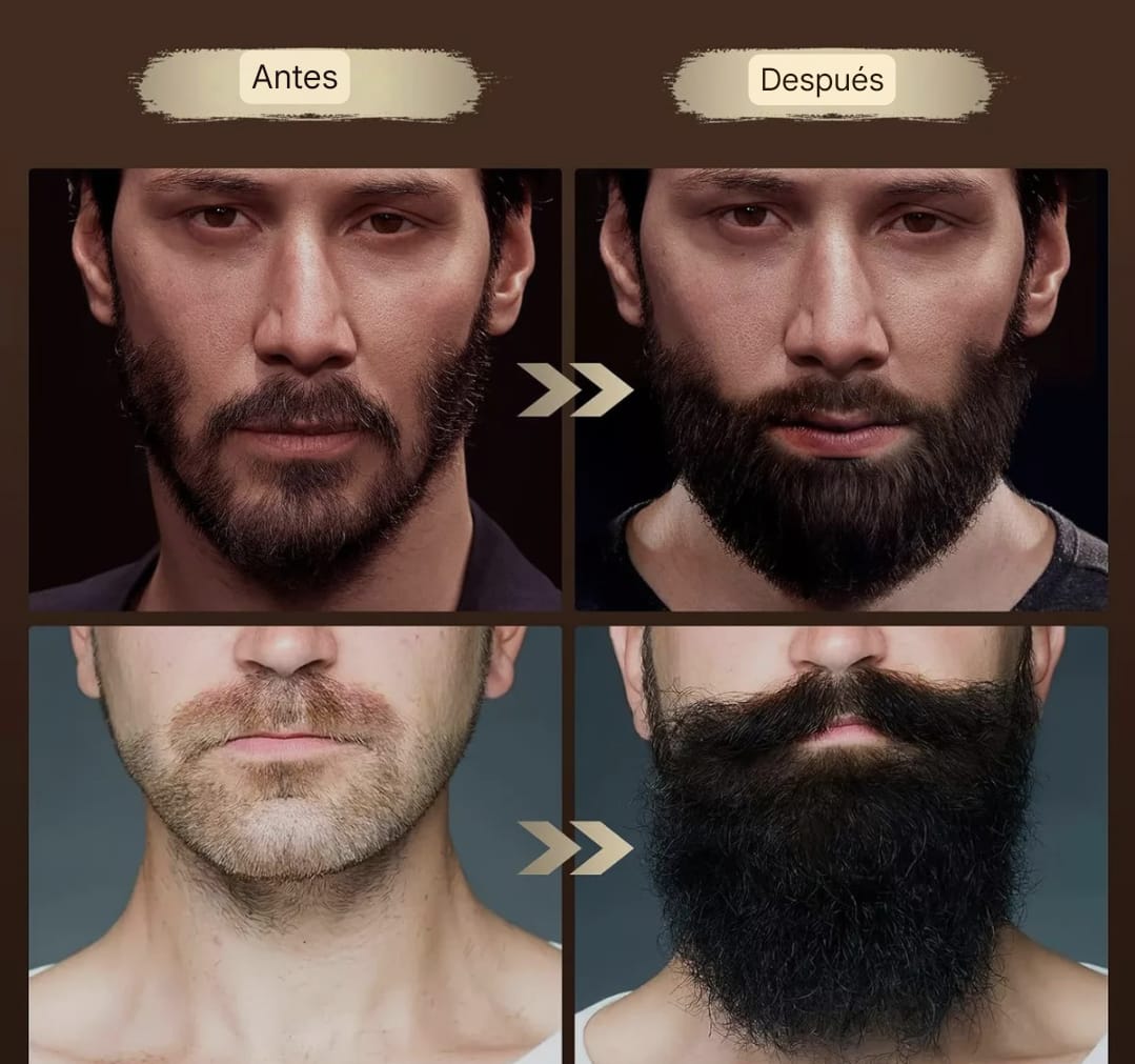 COMBO: Sadoer para el Crecimiento de la barba + Dermaroller