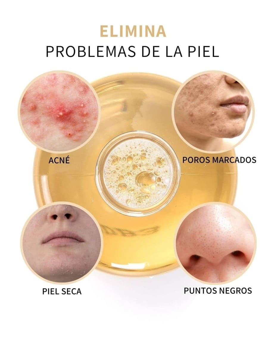 2X1 ÁCIDO GLICÓLICO (Corrige los problemas de la piel)