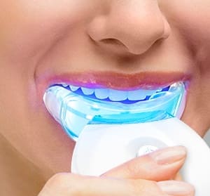 Kit de Blanqueamiento Dental con Tecnología LED