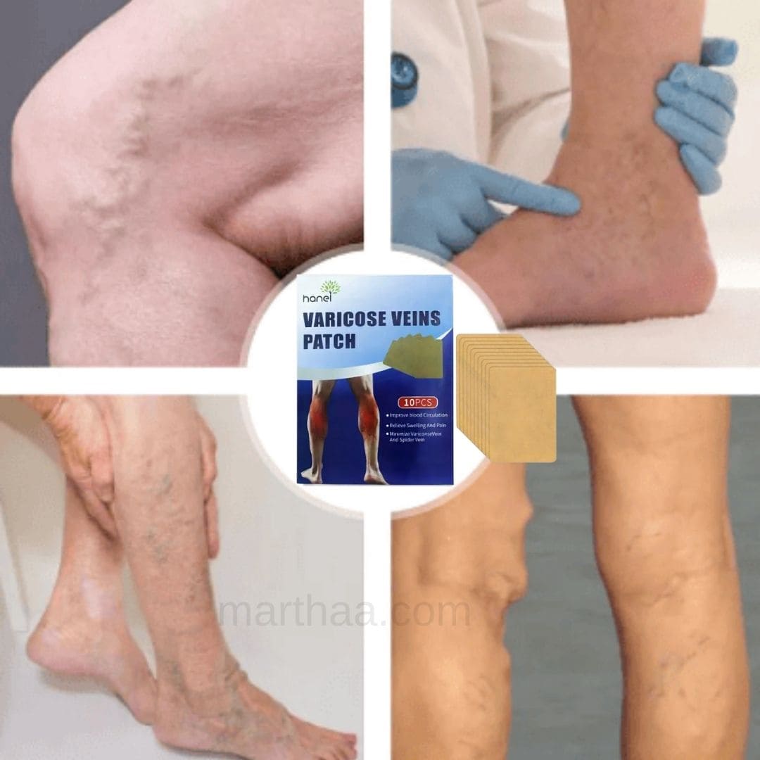 3X1 PARCHES PARA VENAS VARICOSAS 30Unds