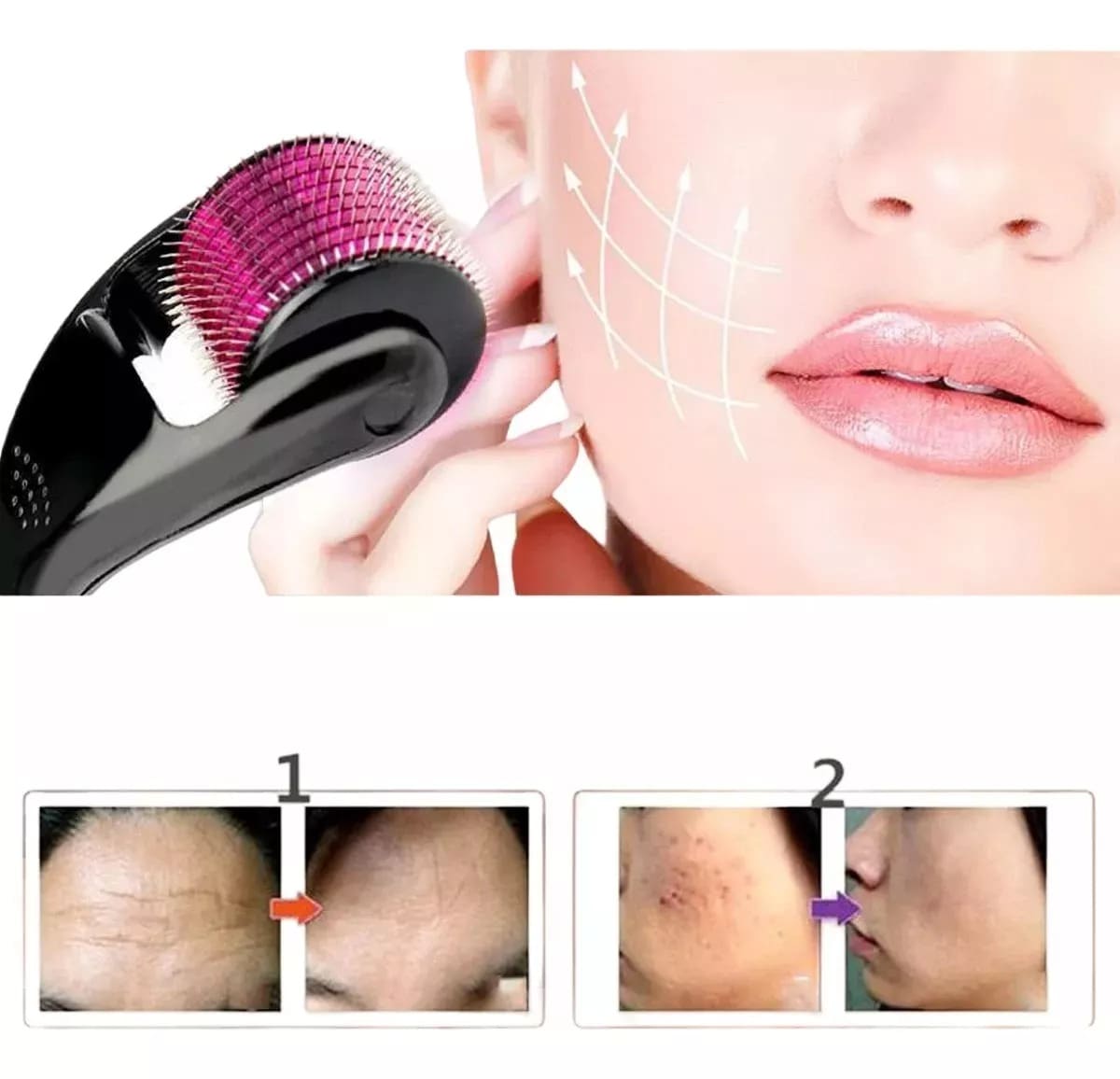 Derma Roller Micro Regenerador