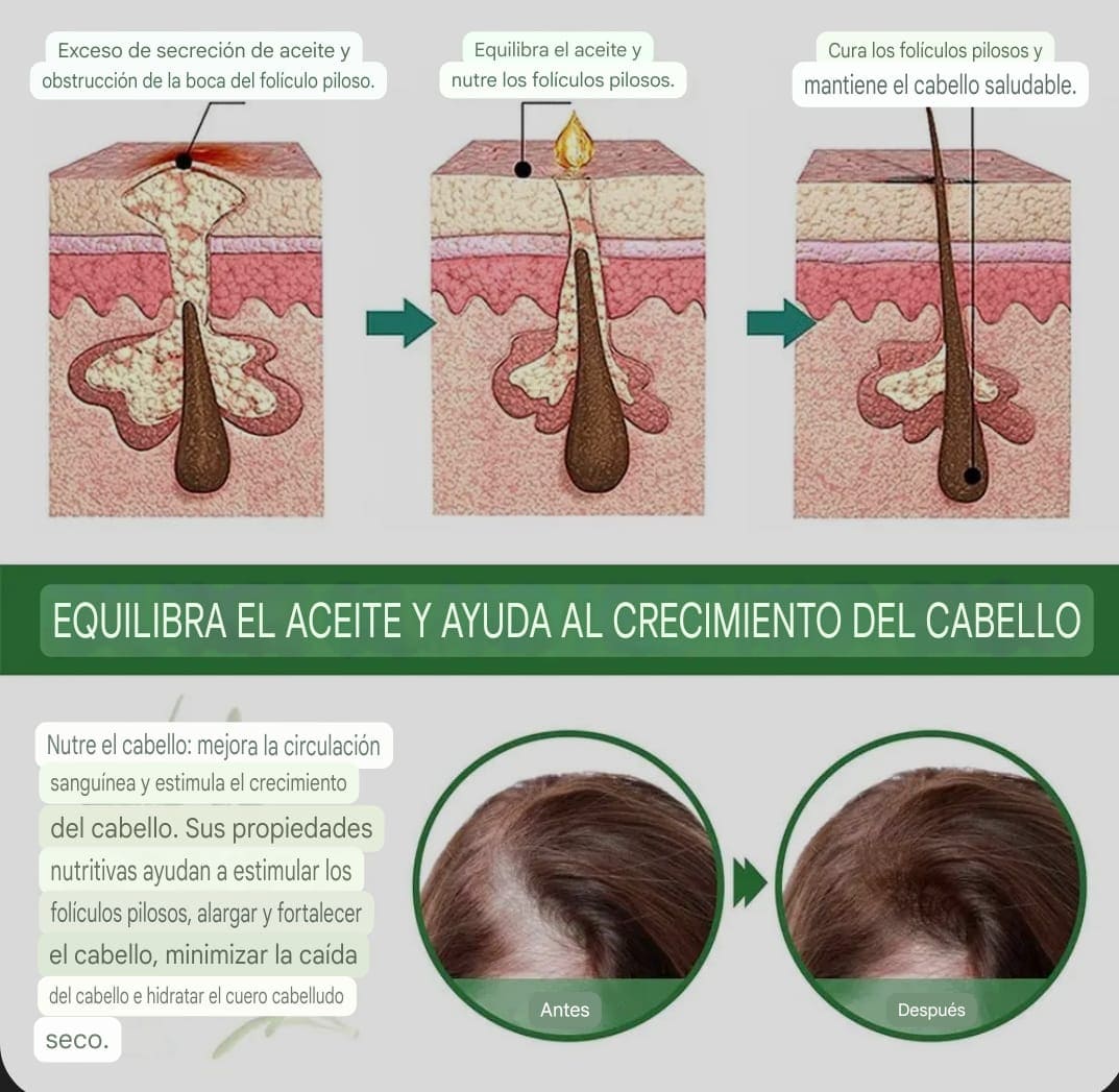 ACEITE DE ROMERO (Para detener la caída del cabello y hacerlo crecer)