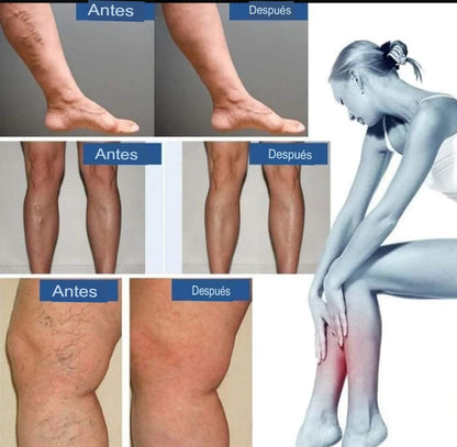 3X1 PARCHES PARA VENAS VARICOSAS 30Unds